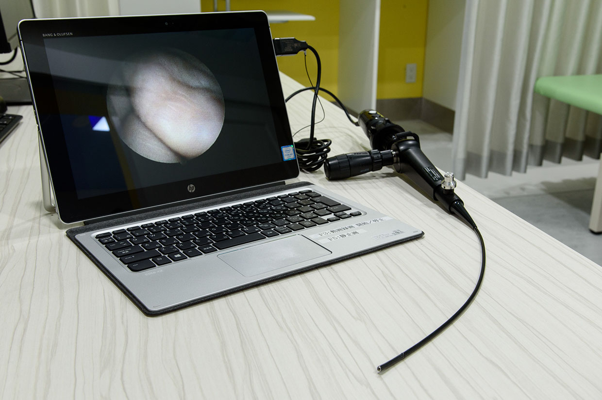 嚥下内視鏡検査