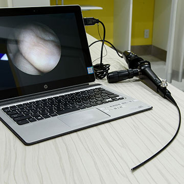 嚥下内視鏡検査