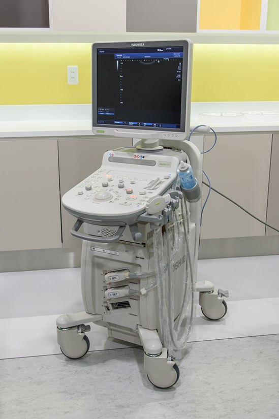 超音波診断装置