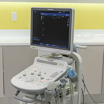 超音波診断装置