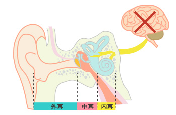 脳の病気によるめまい
